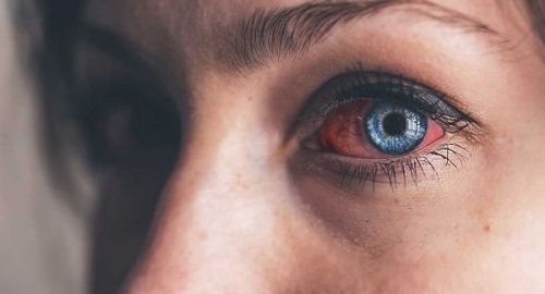 عفونت چشم از عوارض استفاده مداوم و طولانی مدت از لوازم آرایش