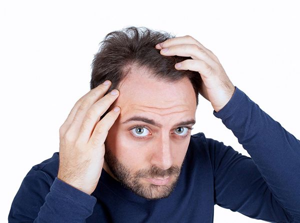 ریزش مو از عوارض استفاده از ژل موی سر