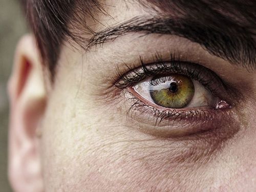 13 روش طبیعی برای درمان سیاهی زیر چشم در خانه