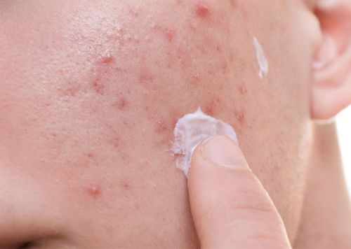 محصولات آرایشی نامرغوب و بروز اختلالات پوستی که باید مراقب آن‌ها باشید