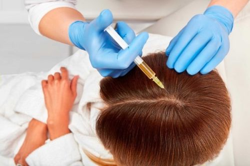 درمان ریزش مو به روش اگزوزوم تراپی