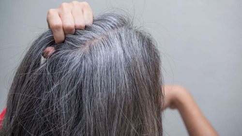 8 علت مهم سفید شدن موها و راه‌های درمان آن